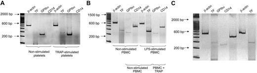Figure 1. TF mRNA in human platelets and PBMCs. Platelet and PBMC RNAs were extracted before and after stimulation with 5 μM TRAP for 15 minutes. PBMCs were also stimulated for 2 hours with LPS. (A) Amplification of mRNA transcripts in nonstimulated and TRAP-activated platelets. β-actin represents housekeeping transcripts. In this particular experiment, TF mRNA was detected after TRAP stimulation but not in nonstimulated platelets. The platelet origin of TF mRNA was demonstrated by the amplification of GPIbα mRNA in nonstimulated platelets, by the TF mRNA increase after TRAP activation, and by the lack of transcripts for monocyte CD14 mRNA. (B) PCR amplification of cDNAs of nonstimulated and LPS-stimulated PBMC preparations for 2 hours. CD14 mRNA bands are distinctive of monocytes. TF mRNA was barely detectable in unstimulated PBMCs, although markedly increased after 2 hours of stimulation with LPS. Platelet mRNA in the PBMC suspensions was demonstrated by the observation of GP-1bα amplification in nonstimulated and activated samples. (C) Reverse transcriptase–PCR products of nonactivated and 5 μM TRAP-activated PBMC suspensions. TF mRNA was only slightly enhanced after TRAP stimulation when compared with LPS stimulation in panel B. This mild increase was observed in 3 of 8 experiments, whereas in the remaining 5 experiments, it was unnoticed. Barely visible GPIbα mRNA transcripts were detected, confirming platelet contamination in PBMC preparations. The amplification products were run with a 100-bp ladder in 8% polyacrylamide gel and were silver stained. Negative controls without template showed no amplification products (not shown). gDNA products of β-actin, TF, and CD14 (Table 1) were undetected in all the experiments.