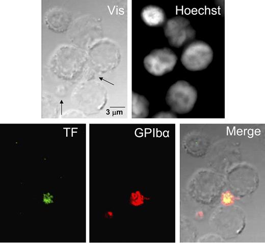 Figure 5. Confocal immunofluorescence of TF and GPIbα in nonstimulated PBMC preparations. Unstimulated, fresh, nonpermeabilized suspensions of PBMCs were examined by contrast microscopy, Hoechst staining, and TF and GPIbα immunolabeling. No TF label is observed in leukocytes, whereas 1 platelet stained strongly for TF and GPIbα, with extensive colocalization of both glycoproteins. The other platelet is identified only by expression of the GPIbα label. Vis is phase contrast; arrows in Vis show platelets expressing GPIbα label.
