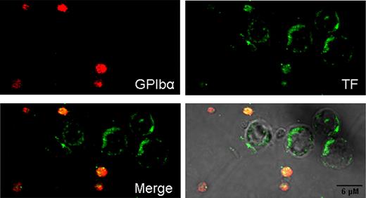 Figure 6. Confocal immunofluorescence of TF protein expressed by LPS-stimulated PBMC preparations. PBMC suspensions, similar to those of Figure 5, were stimulated with LPS during 5 hours. Here, a distinctive TF label is observed in the cell periphery of leukocytes (presumably monocytes). Contaminating platelets stained strongly for GPIbα and TF, which showed extensive colocalization.