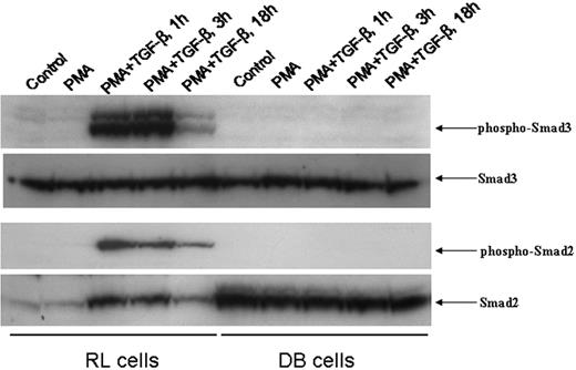 Figure 2. Time course of nuclear translocation of phospho-Smad3 and phospho-Smad2 induced by PMA/TGF-β treatment. An equal amount of nuclear lysates (30 μg) from RL and DB cells treated with PMA/TGF-β for the time points indicated were analyzed by Western blot analysis. The membranes were probed and reprobed after stripping with different antisera as indicated above.