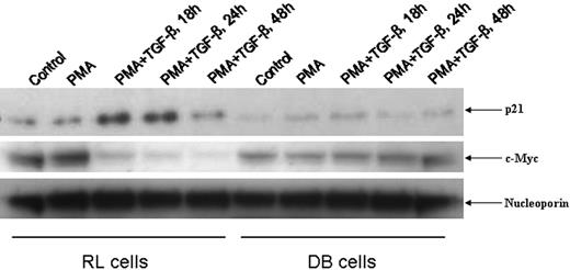 Figure 3. Status of nuclear p21Cip1/WAF1 and c-Myc in RL and DB cells. An equal amount of nuclear lysates (30 μg) from RL and DB cells treated with PMA/TGF-β for the time points indicated were analyzed by Western blot analysis. The membranes were probed and reprobed after stripping with different antisera as indicated above.