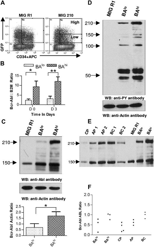 Figure 1. Selection of CD34+ cells expressing high and low levels of Bcr-Abl. (A) Human CD34+ cells were transduced with MIG R1 and MIG 210 retrovirus as described in “Patients, materials, and methods.” Transduced CD34+ cells were selected by flow cytometry sorting. CD34+GFP-low (BAlo) and CD34+GFP-high (BAhi) populations were selected from MIG 210–transduced cells and a single CD34+GFP+ population was selected from MIG R1–transduced cells as shown. (B) Bcr-Abl mRNA expression in transduced cells was assessed using quantitative RT-PCR and expressed as the ratio of Bcr-Abl/β2M as described in “Patients, materials, and methods.” The results shown are for freshly sorted cells (day 0) and for cells cultured for 72 hours (on day 3). Significance levels for differences between BAlo and BAhi cells were *P < .02 and **P < .036. (C) Bcr-Abl protein expression in transduced cells was assessed by Western blotting. Cells were cultured for 48 hours after sorting and protein extracts prepared as described in “Patients, materials, and methods.” Western blotting was performed using anti-Abl antibodies. Blots were reprobed with an antiactin antibody to confirm equal sample loading. Significance levels between BAlo and BAhi cells is *P < .026. (D) Protein tyrosine phosphorylation in transduced cells was assessed by Western blotting using an antiphosphotyrosine (anti-PY) antibody. (E) Protein extracts were obtained from transduced CD34+ and CD34+ cells isolated from samples obtained from CML patients, and Western blotting was performed with anti-ABL and antiactin antibodies. Results from a representative experiment are shown. (F) Bcr-Abl/ABL ratios obtained by densitometric analysis of BAlo and BAhi cells (n= 3) and primary CML CD34+ cells (n= 10) are shown.