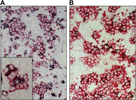 Figure 1. Expression of the rat ED2 antigen by macrophages in splenic erythroblastic islands. Microphotographs from the red pulp areas from the spleens of a juvenile 7-day-old rat (A), or an adult animal 6 days after P berghei infection (B), double-stained with mAb ED2 for rat CD163 (black) and mAb OX26 for rat transferrin receptor–positive erythroblasts (red).
