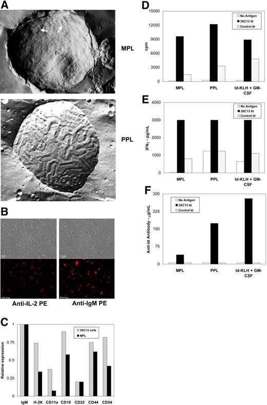 Figure 1. Characteristics of MPL and PPL lymphoma vaccines and immune responses induced following vaccination. (A) Freeze fracture electron microscopic image of membrane proteoliposome (MPL) demonstrates a “bumpy” texture (arrows) resembling that of tumor cell membranes and sections with a ripple texture characteristic of DMPC bilayers. The purified protein proteoliposome (PPL) shows a predominant DMPC ripple texture with bulges that may be caused by protein and associated water pockets trapped between the lamellae. Samples without cryoprotectant were placed between copper specimen carriers and rapidly plunged into liquid propane. Fracturing and replicating was performed at −115°C in a Balzers BAF 400T Freeze-Etch unit (Liechtenstein). Cleaned replicas were viewed on a Philips EM 300 transmission electron microscope (Netherlands) at a magnification of approximately 55 000 fold and photographed using built-in plates. (B) Immunofluorescent staining of membrane proteoliposomes (MPL) with anti-IL-2 PE and anti-mouse IgM PE antibodies demonstrated the presence of IL-2 (bottom left panel) and tumor-derived idiotype (bottom right panel) on the surface of the liposomes. Phase contrast images are also shown for comparison (top panels). Samples consisting of wet mounts in phosphate buffered saline were viewed using a Nikon Optiphot II Epifluorescence microscrope (Melville, NY) at 500 fold magnification with a 40×/0.75 Plan Fluor Ph2 DLL objective (Nikon, Melville, NY). Images were collected using a Spot RT Color Digital camera (Diagnostic Instrumentations, Inc., Sterling Heights, MI) and Image-Pro-Plus #4 acquisition software (Media Cybernetics, Bethesda, MD). (C) Relative expression levels of membrane proteins were measured on 38C13 murine lymphoma cells and on MPL proteoliposomes prepared from a membrane extract of the same cells. Cells and MPL proteoliposomes were incubated with biotin-labeled monoclonal antibodies to the indicated surface proteins, washed, and then incubated with europium (Eu)-labeled streptavidin. Following washing, the amount of bound Eu was measured on a Delfia 1232 time-resolved fluorometer (Wallac, Gaithersburg, MD). The relative expression level of each membrane protein was determined by dividing its Eu value by that of the 38C13 IgM measured in the same preparation (38C13 cells or MPL proteoliposomes; ie the IgM was assigned a relative expression value of 1.0). (D-F) Mice were inoculated once intraperitoneally with MPL vaccine, PPL vaccine, or Id-KLH + GM-CSF and tested for immune responses after 14 days. Draining lymph node cells were cultured in the presence or absence of tumor-specific 38C13 idiotype or control idiotype and proliferation assay (d) and cytokine induction assay for IFN-γ production (E) were performed as previously described.11 Plasma antibody levels specific for 38C13 idiotype were determined by ELISA (F).11 Data in panels d-f are representative of those obtained in 3 independent experiments each.
