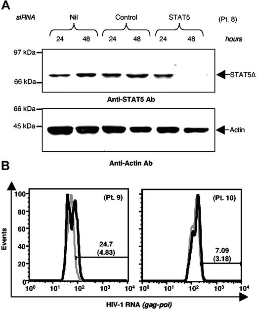 Figure 6. STAT5 silencing enhances HIV RNA expression in IL-2 stimulated CD8-depleted PBMC of HIV-positive individuals. (A) Western blot analysis of WCE of PBMC from individual number 8 (patient no. 8) after electroporation with either control or STAT5 siRNA. Membranes were sequentially hybridized with anti-STAT5 mAb (upper panel) and a control anti-α-actin Ab (lower panel). (B). CD8-depleted PBMC from patient nos. 9 and 10 were electroporated with either control or STAT5 siRNA; 24 hours later, the cells were resuspended in a medium enriched with IL-2 and intracellular HIV RNA expression was analyzed by flow cytometry after 4 days of cultivation; gray thick histograms: scramble control siRNA; black thick histograms: STAT5 siRNA.