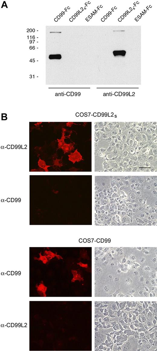 Figure 1. Anti-CD99L2 and anti-CD99 antibodies specifically react only with their corresponding antigen. (A) Immunoblots of CD99-Fc, CD99L2S-Fc, and ESAM-Fc (as indicated above) with affinity-purified antibodies against CD99 and CD99L2 (as indicated below). (B) Immunofluorescence staining of COS-7 cells transiently transfected with full-length CD99L2s (top panel) or full-length CD99 (bottom panel) using affinity-purified antibodies against CD99 or CD99L2 (as indicated on the left). Bar = 25 μm.