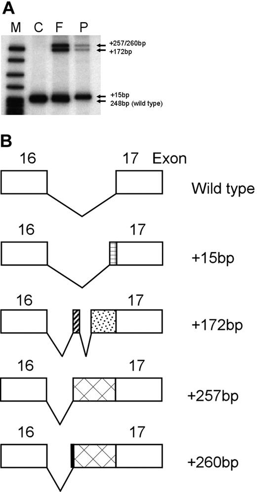 Figure 1. Splicing analyses of the ankyrinAnkara mutation in reticulocyte RNA. (A) To determine if the ankyrinAnkara mutation was associated with altered mRNA splicing, reticulocyte RNA was reverse transcribed with oligo d(T). RT products were PCR amplified with primers in exons 15 and 17. M indicates markers. Control (C) reticulocyte RT-PCR product yielded the expected cDNA fragment of 248 bp. In the father (F), the expected band of 248 bp and 3 additional bands of higher molecular weight were visualized. In the proband (P), the normal 248-bp cDNA product was not seen and only the 3 additional higher molecular weight bands visualized in the father's cDNA were found. (B) Determination of the nucleotide sequence of these higher molecular weight bands yielded novel ankyrin cDNA isoforms containing additional sequence of +15 bp, +172 bp, +257 bp and +260 bp, respectively, from the 3′ end of intron 16. The corresponding predicted splicing patterns of these isoforms are shown.