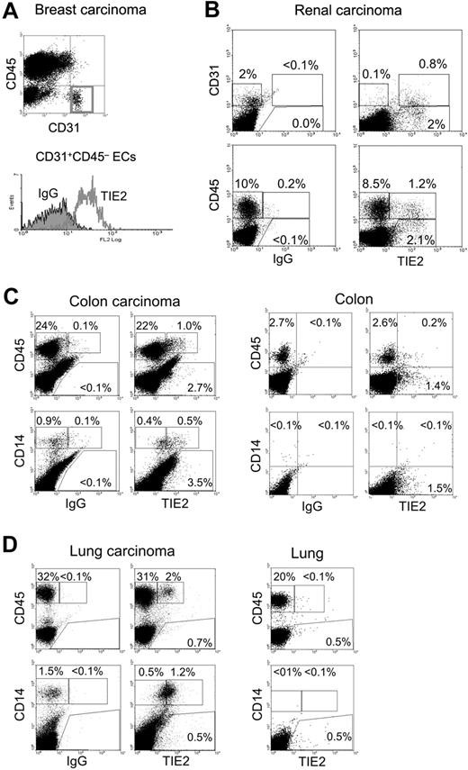 Figure 4. TIE2+ monocytes are found in human tumors. Flow cytometry analysis of the indicated tumor specimens, processed and analyzed as described in the text. FITC-conjugated anti-CD31 or anti-CD14, PE-conjugated anti-TIE2, or APC-conjugated anti-CD45 antibodies were used. (A) Breast carcinoma. Note that the gated CD31+CD45− tumor-derived ECs are TIE2+ (red open line in the histogram on the right; filled line is the IgG isotype control). (B) Renal carcinoma. In this tumor specimen, approximately 2% of the tumor-derived cells are CD31+ (CD45−, not depicted) ECs. The wide majority of these CD31+ tumor-derived ECs are TIE2+. Note that a fraction of the tumor-derived cells are CD31−TIE2+ non-ECs (top right dot plot). In the same tumor sample, approximately 10% of tumor-derived cells are CD45+ hematopoietic cells. Only a minor fraction (12%) of these CD45+ cells are TIE2+ (bottom right dot plot). (C) Colon carcinoma (left) and nonneoplastic colon mucosa (right). In the tumor, 4% of the abundant CD45+ hematopoietic cells and most of the CD14+ monocytes are TIE2+. In the normal mucosa, CD45+ hematopoietic cells are much less abundant than in the tumor, and only a few TIE2+ cells are found. Note that CD14+ monocytes are not detected in the normal mucosa. (D) Lung adenocarcinoma (left) and nonneoplastic lung tissue (right). In the tumor, more than 30% of the cells are CD45+ hematopoietic cells, of which 6% are TIE2+. Most of the tumor-derived CD14+ monocytes are TIE2+. In the normal lung tissue, the CD45+ hematopoietic cells are TIE2−; note that CD14+ monocytes are not found in this tissue.