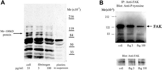 Figure 4. Platelet adhesion to low-density fibrinogen induces greater protein tyrosine phosphorylation than adhesion to high-density fibrinogen. Platelets were allowed to adhere to fibrinogen (fbg)–coated or collagen (coll)–coated wells for 1 hour. After washing, adherent platelets were lysed in a buffer containing phosphatase inhibitors as described in “Materials and methods.” (A) Equal amounts of protein were subjected to electrophoresis and immunoblotting with mAbs specific for phosphotyrosine. Phosphotyrosine staining of proteins was less intense in platelets adherent to high-density compared with low-density fibrinogen; a protein of Mr approximately 100 kDa demonstrated approximately 50% less intense staining in platelets adherent to high-density than to low-density fibrinogen. For comparison, phosphotyrosine staining of proteins from platelets in suspension prior to adhesion is shown. (B) Equal amounts of protein lysates were used to immunoprecipitate FAK. Immunoprecipitated proteins were analyzed by immunoblotting for phosphotyrosine. Thereafter, the membranes were stripped and reanalyzed with antibody to FAK, to verify that the amounts of immunoprecipitated proteins were equal in all lanes. Results shown are representative of 3 independent experiments.