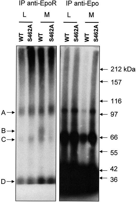 Figure 5. Protection from proteasomal degradation of Epo-RS462A. BaF3 cells expressing either Epo-RWT or Epo-RS462A were preincubated with LLnL (L) or methylamine (M) for 15 minutes and stimulated for 30 minutes with125I-Epo. After washing to remove unbound radioactivity, the cells were lysed, and clarified cell extracts were crosslinked with 2 mM of BS3. Excess crosslinking reagent was blocked with ethanolamine, and Epo-R was precipitated with a polyclonal antibody directed against the intracellular domain of the receptor (C-236). Precipitates were denatured by boiling in sodium dodecyl sulfate and subsequently immunoprecipitated again with the same antibody (left panel). Lastly, nonprecipitated125I-Epo-crosslinked proteins were recovered by immunoprecipitation with anti-Epo antibodies (right panel). Experiment analysis was performed by polyacrylamide gel electrophoresis and autoradiography.