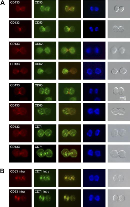 Figure 5. Localization of CD53, CD62L, CD63 and CD71 in dividing CD34+CD133+ cells. (A) Cell-surface distribution of CD53, CD62L, CD63, and CD71 on late mitotic CD34+CD133+ cells. For each of these markers, 1 mitotic cell is shown containing a symmetric distribution of the given antigen (top row), and 1 containing an asymmetric distribution (bottom row; green staining). Cells are counterstained with an anti-CD133 antibody (red staining) and DAPI (blue staining). Light microscopy images of the stained cells are presented in the fifth column. (B) Intracellular distribution of CD63 (red staining) and CD71 (green staining). The overlay of the 2 is given in the third column.