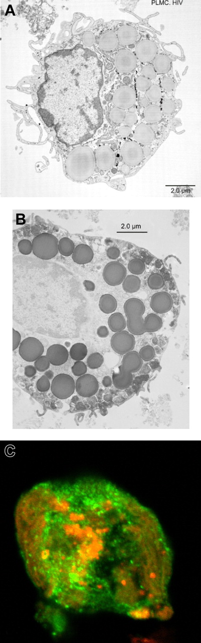 Figure 3. Mature PLMCs can be isolated from human placental tissues. TEM imaging revealed that isolated placental MCs typically exhibited (A) an ovoid nucleus and an irregular outer cellular membrane characterized by microvilli, and (B) TEM image showing multiple immunoperoxidase-positive cytoplasmic granules indirectly stained using a mast cell tryptase-specific monoclonal antibody. (C) Laser scanning confocal microscopic imaging confirmed that isolated PLMCs cultured in the presence of SCF are positive for cell surface–expressed CD117 (PE in red) and mast cell tryptase (FITC in green).