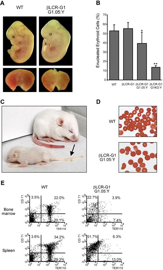 Figure 3. Rescue of the Gata1.05 mutant by the βLCR-G1 transgene. (A) Rescue of G1.05 fetuses by the βLCR-G1 transgene (line B) at E12.5. Top panel: E12.5 fetuses of genotypes indicated; bottom panel: their fetal livers. (B) Flow cytometric analysis of the percentage of enucleated (FSClow TER119+) erythroid cells in WT, βLCR-G1, βLCR-G1::G1.05:Y, and βLCR-G1::G1KO:Y E12.5 fetal livers cells after 2 days in hanging drop cultures. Enucleation was determined by cell size (FSClow). Significant difference: *, P < .05; **, P < .002, compared with WT (unpaired t test). (C) βLCR-G1::G1.05:Y pup and wild-type littermate 11 days after birth; anemia is evident as pallor of the tail (arrow). (D) Peripheral blood of βLCR-G1::G1.05:Y pup and wild-type littermate; original magnification, 40×. (E) Flow cytometric analysis of bone marrow (top panel) and spleen (bottom panel) of βLCR-G1::G1.05:Y pup and wild-type littermate. Percentages of cells expressing CD71 and/or TER119 are indicated.