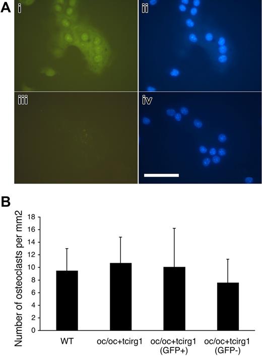 Figure 3. Cells harvested from oc/oc+tcirg1 mice can be in vitro–differentiated to osteoclast-like cells in normal numbers. BM cells from oc/oc+tcirg1 mice were cultured for 6 days with M-CSF and RANK-L after which generation of osteoclast-like cells was analyzed. (A) Both GFP+ (i-ii) and GFP− (iii-iv) osteoclast-like cells were formed. (i, iii) Green fluorescent; (ii, iv) blue fluorescent (DAPI) image. Bar represents 100 μm. Microscope: Leica DM IL PLAN 40× magnification, 0.5 lens; camera: Leica DFC320; and acquisition software: Leica IM500. (B) Osteoclasts were cultured on bone slices from BM cells obtained from WT or oc/oc+tcirg1 mice. Oc/oc+tcirg1 cells were also FACS sorted into GFP+ and GFP− populations. After culture with M-CSF and RANKL for 6 days, the number of multinucleated (≥ 3 nuclei) cells was enumerated. Mean ± SD is shown.