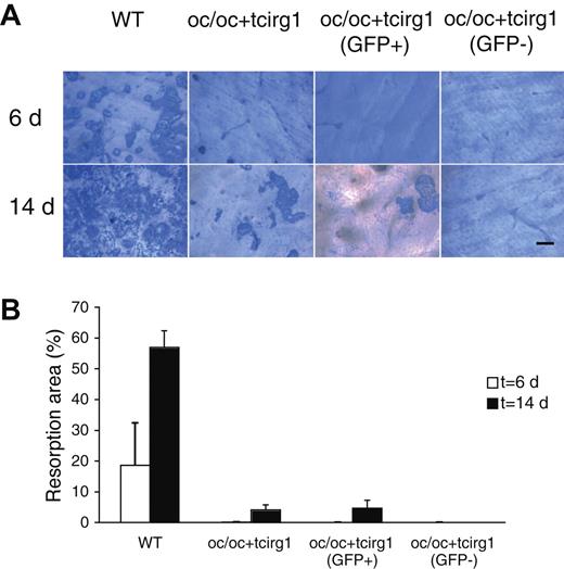 Figure 4. In vitro–differentiated cells from oc/oc+tcirg1 mice are capable of bone resorption. Osteoclasts were cultured from BM cells harvested from WT or oc/oc+tcirg1 mice. In addition, oc/oc+tcirg1 cells were FACS sorted into GFP+ and GFP− populations. After culture with M-CSF and RANKL for 6 or 14 days on cortical bone slices, cells were removed and resorption pits were visualized. (A) Examples of bone resorption pits formed by WT, oc/oc+tcirg1–, oc/oc+tcirg1 (GFP+)–, and oc/oc tcirg1 (GFP−)–derived osteoclasts after 6 (upper panel) and 14 (lower panel) days. Bar represents 100 μm. For microscope and camera model, see Figure 3B legend. (B) Percentage of bone surface resorbed after 6 (empty bars) or 14 (solid bars) days of culture. Mean ± SD of a triplicate plating is shown.