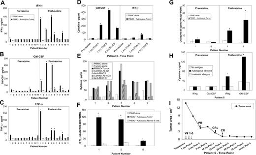 Figure 1. Tumor-specific cellular immune responses were induced following vaccination. Cryopreserved prevaccine and postvaccine PBMCs were cultured in either medium alone, or with sCD40Lt activated autologous tumor cells in the presence or absence of HLA class I and class II blocking antibodies or their respective isotype control antibodies or sCD40Lt activated autologous normal B cells or autologous or irrelevant idiotype protein and cytokine production was detected by ELISA or ELISPOT as previously described.6,12–14 Cytokine production in the supernatants for IFN-γ (A, D), GM-CSF (B, D), and TNF-α (C) was measured by ELISA. (D) Representative data on the cytokine production in response to autologous tumor cells from PBMC samples obtained at various time points in patient 3. (E) Tumor-reactive immune responses in postvaccine PBMC were associated with both HLA class I and class II molecules. IFN-γ production is shown for patients 1, 3, 5, and 6, and TNF-α production is shown for patient 9. (F) Significantly increased numbers of IFN-γ spots were detected by ELISPOT in response to autologous tumor cells but not in response to autologous normal B cells in 3 patients (P < .05). (G) Significantly increased numbers of Granzyme B spots were detected by ELISPOT in response to autologous tumor cells in postvaccine but not prevaccine PBMC samples (P < .05). (H) Postvaccine but not prevaccine PBMC from patient 5 produced significant amounts of cytokines in response to autologous idiotype protein compared with control isotype-matched irrelevant idiotype protein. (I) Induction of complete remission following vaccination. Vaccination time points are indicated by arrows. The sum of the product of the perpendicular diameters of 4 separate lymph nodes measured on CT scans is represented on the y-axis. PR - partial response; CRu - complete response, unconfirmed; CR - complete response.