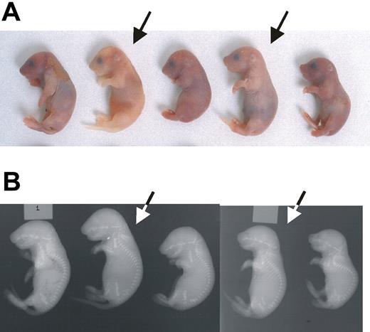 Figure 3. Phenotype of Ggcx−/− mice. (A) Newborn progeny from a Ggcx+/− intercross. The homozygous null animals (arrows) exhibit intra-abdominal hemorrhage. (B) X-rays from the same animals shown in panel A. Arrows again indicate the homozygous null mice.