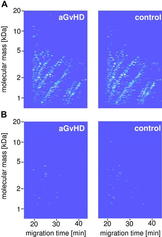 Figure 1. Polypeptide pattern distinguishing HSCT patients with aGvHD from HSCT controls. This figure shows the compiled data sets of 13 GvHD samples (A, top left panel) and 50 HSCT control (top right panel) of the training set (Table 1). Normalized molecular weight is plotted against normalized migration time. The mean signal intensity is color coded. (B) The bottom panel depicts the 31 indicative polypeptides defining the specific pattern for GvHD (bottom left panel) and controls (bottom right panel).