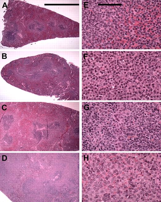 Figure 2. Splenic MZL in F1BC NZB mice. The left column (A-D) contains low-power (5.5 × objective; bar is 5 cm) photomicrographs of selected mice spleens showing the various stages of MZL seen: early marginal zone hyperplasia and the confluence of 2 or more GCs (A-B); moderate and massive infiltration of the red pulp (C-D). The right column (E-H) shows selected areas of involvement at a higher power (43 × objective; bar is 100 μm) for cellular detail.