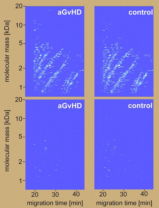 Analysis of urinary polypeptide patterns of aGvHD and non-aGvHD using CE-MS. See the complete figure in the article beginning on page5511.