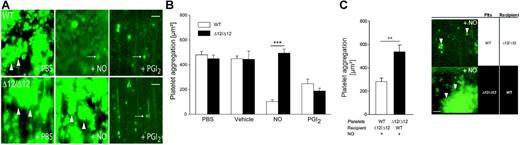 Figure 4. In vivo analysis of arterial thrombosis in wild-type and IRAGΔ12/Δ12 mice. (A) Thrombus formation in the injured carotid artery of wild-type (WT) and IRAGΔ12/Δ12 mice in the absence or presence of NO (50 μM NO-spermine) or PGI2 (50 μM iloprost) (arrowheads indicate thrombi; arrows, single, adherent platelets). (B) Statistical evaluation of thrombus formation as measured by the size of platelet aggregates (in μm2) Analysis was performed with n = 6 to 9 PBS-, vehicle (NaOH)–, NO- or PGI2-treated WT or IRAG mutant mice. (C) Thrombus formation after infusion of IRAGΔ12/Δ12 or WT platelets into the injured carotid artery of WT or IRAGΔ12/Δ12 mice (recipient), respectively, in the presence of NO (50 μM NO-spermine) (arrowheads indicate thrombi, n = 4). Representative videoclips of thrombus formation in WT or IRAGΔ12/Δ12 mice from panel A in the presence or absence of nitric oxide are available as Videos S1–S4.
