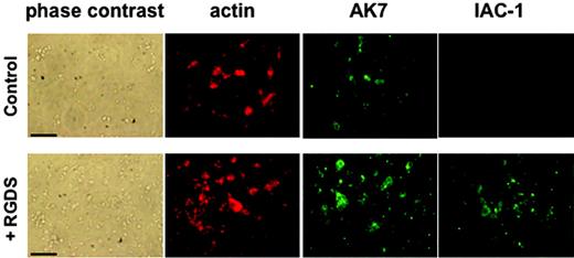 Figure 3. IAC-1 binding to α2β1 on RGDS-treated washed platelets under static adhesion conditions. Unstimulated or RGDS-treated washed platelets were allowed to adhere to immobilized collagen type III–coated coverslips for 60 minutes. After fixation and permeabilization, cells were incubated with phalloidin–Texas Red (200 nM) to stain actin and AK-7 (5 μg/mL), followed by a 1:50 dilution of rabbit anti–mouse IgG–FITC, to stain α2β1 or IAC-1–FITC (10 μg/mL) to stain activated α2β1. Scale bars indicate 25 μm.