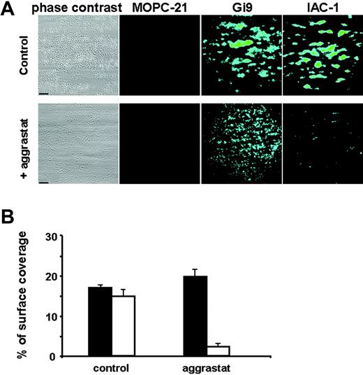 Figure 5. Inhibition of fibrinogen binding to αIIbβ3 decreases IAC-1 binding to adhering platelets under flow conditions. Anticoagulated whole human blood was perfused over a collagen-coated surface at a wall shear rate of 1000 s−1. Postperfusion was performed with either FITC-labeled MOPC-21 (5 μg/mL), FITC-labeled Gi9 (5 μg/mL), or FITC-labeled IAC-1 (10 μg/mL). (A) Representative phase-contrast (left column) and fluorescence (right columns) microscopic images of adhered platelets after 4 minutes of perfusion in the presence (bottom row) or absence (top row) of aggrastat. Scale bars indicate 25 μm. (B) Platelet adhesion in the presence or absence of aggrastat, determined as a percentage of surface coverage. Data obtained from phase-contrast images are in black; fluorescence data of IAC-1–FITC images are in white. Data are expressed as the mean ± SE of 10 images of at least 3 independent experiments.