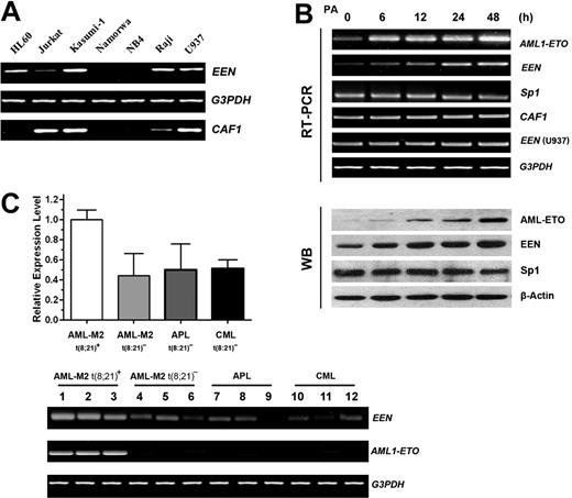 Figure 2. High expression levels of the EEN gene in leukemic cells with AML1-ETO. (A) RT-PCR analyses of EEN and CAF1 mRNA in leukemic cell lines. Myeloid lineages: Kasumi-1, HL60, U937, and NB4; lymphoid lineages: Jurkat, Namalwa, and Raji. (B) RT-PCR (top 6 rows) and Western blot analyses (bottom 4 rows) of AML1-ETO, EEN, Sp1, and CAF1 in the Ponasterone A (PA)–inducible, AML1-ETO–expressing U937 cell line. Cells were treated with 5 μM Ponasterone A to induce AML1-ETO expression. A 2-fold increase of EEN expression was observed 48 hours after PA treatment, in contrast to Sp1, which showed no obvious change in expression level. (C) RT-PCR analysis (bottom) and quantitative real-time RT-PCR analysis (top) of EEN in leukemic patient samples with or without AML1-ETO. Each leukemia subtype included 8 cases. The EEN-expression level in M2 t(8;21)+ was significantly higher than the other 3 subtypes without t(8;21) (P < .01), whereas no difference was detected between patients negative for t(8;21) (P > .1). Each column represents the mean ± SD in 8 cases. AML indicates acute myeloid leukemia; APL, acute promyelocytic leukemia; CML, chronic myeloid leukemia.