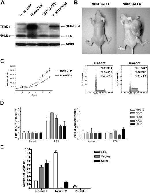 Figure 5. Oncogenic properties of cells with EEN overexpression. (A) Western blot analysis showing overexpression of EEN in stably transfected NIH3T3 and HL60 cells (2.3-fold in NIH3T3-EEN and 4-fold in HL60-EEN compared with the endogenous level). (B) Tumor formation in nude mice injected with NIH3T3-EEN. (C) Cell proliferation and cell-cycle distribution of HL60-GFP and HL60-EEN cells. The result of 1 representative experiment is shown. (D) Activation of AP-1 (left panel), but not CRE (right panel), by EEN. (E) Colonies generated per 104 transduced BM cells were determined in first-, second-, and third-round cultures for MigR1-EEN construct, MigR1 empty vector, and nontransfected BM cells. GFP+ colonies were counted at the end of each round. Bars represent the mean plus or minus SD for 3 experiments.