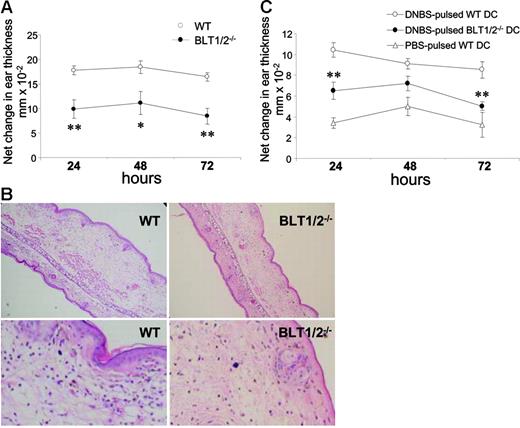 Figure 7. Defective CHS in BLT1/2−/− mice. (A) WT and BLT1−/− mice were sensitized on the shaved abdominal skin with 50 μL of 0.5% DNFB in 4:1 acetone/olive oil (vol/vol) and 5 μL on each footpad. Five days later, mice were challenged on the right ear (10 μL of 0.2% DNFB on each side). The left ear was painted with vehicle as control. Increases in ear swelling were measured at different time points. Mean values ± SE for each group (5 mice) are presented. (*P < .05, **P < .01 by t test, vs respective WT control group). One experiment representative of 3 is shown. (B) Histology, hematoxylin and eosin–stained tissue sections from WT and BLT1/2−/− mice after 24 hours read-out CHS. The top row represents a ×100 magnification; an enlarged region of the same pictures is shown in the bottom row. Images were acquired using a Carl Zeiss Axioskope Optical Microscope equipped with an Achroplan 10 ×/0.25 NA objective and a 10 × eyepiece. Images were captured using a Nikon CoolPix 3.34 Megapixel camera (Nikon, Tokyo, Japan) at a fine resolution of 1600 × 1200 pixels in JPEG format and processed using Adobe Photoshop (Adobe Systems, San Jose, CA). (C) Defective capacity of BLT1/2−/− DCs to elicit CHS. WT mice were immunized (on day −5) by subcutaneous injection of DNBS-loaded DCs (106/mouse) obtained from WT or BLT1/2−/− mice. Mice were challenged 5 days later (day 0) by ear painting with DNFB. Figure represents the values for ear swelling (mean ± SE) of 5 mice per group, and is representative of 3 experiments. **P < .01 by t test.