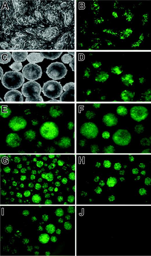 Figure 3. Kinetics of GFP expression in the iSmad1iresEGFP subclone 5. (A) Phase and (B) GFP fluorescence images of untreated and 1-μg/mL doxycycline-treated iSmad1iresEGFP sc5 ES cells, respectively. (C) Phase and (D-F) GFP fluorescence images of day 5.75 iSmad1iresEGFP sc5 EBs that were continuously induced starting on day 0 (D), day 2.75 (E), and day 4 (F). In panels G-J, the iSmad1iresEGFP EBs were induced from day 2 to day 2.25 according to the washout method described in “Materials and methods,” and GFP expression was monitored. (G) Day 2.25 EBs, (H) day 2.5 EBs, (I) day 3 EBs, (J) day 4 EBs. Images were visualized using an AxioCam MRm camera (Zeiss, Thornwood, NY) attached to a Zeiss Axiovert 200M microscope that was equipped with a 10×/0.30 numerical aperture Plan-Neofluar objective. Images were processed using Zeiss Axiovision software version 4.5.