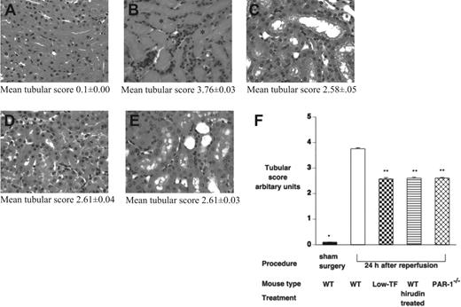 Figure 4. Effect of IR on renal tubular injury. (A-E) Hematoxylin and eosin–stained tissue sections of (A) WT mice undergoing sham surgery followed by 24 hours of reperfusion and of (B) WT, (C) low-TF, (D) C57BL/6 hirudin-treated, and (E) PAR-1−/− mice undergoing 25 minutes of renal ischemia followed by 24 hours of reperfusion. In panel B, tubular cast formation is indicated by *. (F) Tubular injury scores of WT (n = 16), low-TF (n = 7), and WT (n = 7) mice treated with hirudin and PAR-1−/− (n = 16) mice undergoing 25 minutes of bilateral ischemia followed by 24 hours of reperfusion or WT mice undergoing sham surgery. IR injury resulted in significant tubular injury in WT mice compared with sham-operated animals (*P < .001). Low-TF, WT mice treated with hirudin and PAR-1−/− mice had significantly reduced tubular injury compared with WT (**P < .001). Images were captured using an Olympus BX51 microscope equipped with a uPlanFl 40 ×/0.75 numerical aperture (NA) air objective (Olympus, North Ryde, Australia) connected to a Retiga EXi digital camera, and captured with Q capture for Apple Macintosh (QImaging, Burnaby, BC, Canada). Data are expressed as mean ± SEM.