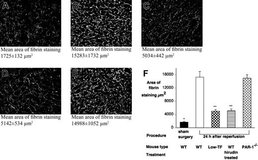 Figure 7. Renal fibrin deposition does not correlate with renal failure or mortality. Renal fibrin deposition was quantified, following 24 hours' reperfusion after 25 minutes of renal ischemia or after sham surgery, by indirect immunofluorescence with an antifibrin/fibrinogen antibody detected with a FITC-labeled secondary antibody. Tissue sections (10 fields per slide, 400×) were viewed with an Olympus BX51 epifluorescence microscope equipped with a uPlanFl 40 ×/0.75 NA air objective, and digital images were captured with a Retiga EXi digital camera. To determine the area of fibrin staining, images were processed with SlideBook 4.0 for Macintosh (Intelligent Imaging, Denver, CO). Representative micrographs of (A) WT sham-operated, (B) WT, (C) low-TF, (D) C57BL6 hirudin-treated, and (E) PAR-1−/− mice 24 hours after renal IR. Mean tubular score ± SEM indicated below each panel. (F) Quantitation of renal fibrin deposition 24 hours after renal IR from WT (n = 12), low-TF (n = 8), WT (n = 12) mice treated with hirudin, PAR-1−/− (n = 12) mice, and sham-operated mice. WT and PAR-1−/− mice undergoing IR had significantly more fibrin staining compared with sham-operated WT mice (*P < .001). Low-TF, and WT mice treated with hirudin had significantly reduced fibrin staining compared with WT mice after IR (**P < .001). Data are expressed as mean ± SEM.
