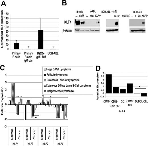 Figure 1. KLF4 is expressed at low levels in B cells transformed by p190 BCR/ABL compared with untransformed B cells. (A) cDNA was prepared from purified resting splenic B cells, splenic B cells activated by anti-IgM, B220+IgM− precursor cells from the bone marrow of wild-type mice, and BCR-ABL–transformed pre-B cells. Real-time quantitative PCR was performed, expression was normalized to β-actin, the value for BCR-ABL–transformed cells was set to 1, and fold-increase was calculated. Data are representative of at least 4 experiments. *P < .02 relative to the BCR-ABL–transformed cells. Error bars indicate standard deviation (SD). (B) Immunoblots were prepared with lysates from indicated cell preparations. The left blot was probed with rabbit anti-KLF4,24 and the right blots with rabbit anti-KLF4 from Santa Cruz Biotechnology. β-Actin was used as a loading control. v-Abl and BCR-ABL indicate transformed pre-B-cell lines; Imat, 4 hours treatment with imatinib (10 μM), the ABL kinase inhibitor; KLF4+, v-Abl cells infected with MIC-KLF4 and sorted for hCD4 24 hours later. The blot on the far right shows cells treated with subtoxic concentrations of imatinib for 24 hours, with sorted KLF4+ infected cells used as a positive control. (C) RNA-expression data from the Oncomine microarray database was compiled for different B-cell malignancies and the normal tissue control for that study, either germinal center B cells or tonsil tissue. Numbers on the y-axis represent the number of standard deviations from the median expression value from thousands of genes tested in each microarray experiment and the P values indicate the significance between the normal and cancer tissue for the respective study (*P < .05, **P < .001). (D) Oncomine data derived from a study41 comparing peripheral blood CD19+ B cells, either resting or activated for 6 hours, total germinal center (GC) cells, a large panel of diffuse large B-cell lymphomas, and chronic lymphocytic leukemias. CD19+GC refers to the average of all nontransformed B-cell samples in the study.