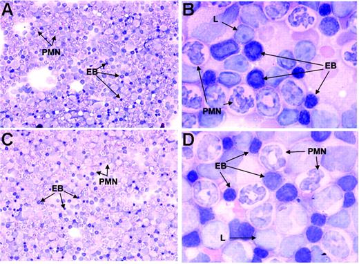 Figure 2. Bone marrow smears. Hematoxylin-eosin staining of bone marrow smear. Original magnifications: × 25 (A, C); × 63 (B,D) from wild-type (A-B) and fch/fch (C-D) 14-week-old BALB/c mice. No structural abnormalities, no erythroid hyperplasia, and no ringed sideroblasts were observed in fch/fch mouse. EB indicates erythroblast; PMN, polymorphonuclear cell; L, lymphocyte. Images were taken with a DMRB microscope equipped with a Leica objective lens (40×/1.00; Leica Microsystems, Rueil Malmaison, France) and connected to a Sony CCD DXC 950P camera (Sony, Cliche, France). Images were processed using Adobe Photoshop 5.0 (Adobe Systems, San Jose, CA).