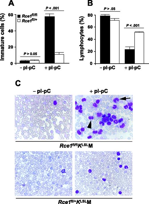 Figure 2. Increased release of immature K-RASG12D–expressing myeloid cells in the setting of Rce1 deficiency. (A) White blood cells were evaluated in blood smears from Rce1fl/flKLSLM (▪; n = 6) and Rce1fl/+KLSLM mice (□; n = 6) harvested before and after pI-pC injections. Immature cells (myeloblasts, promyelocytes, promonocytes, myelocytes, metamyelocytes, band cells, pelgeroid cells) (A) and lymphocytes (B) are plotted as percentages of total white blood cells. Differences between Rce1fl/flKLSLM and Rce1fl/+KLSLM mice were evident 3 weeks after pI-pC injection, and the proportions did not change over time. Thus, data from 3, 5, and 7 weeks were combined. (C) Photographs of blood smears from before and 5 weeks after pI-pC injections (magnification: 100×/1.30 NA oil-immersion objective lens). (Top right panel) Arrowhead, pelgeroid cell; arrow, band cell; large cell in center, myeloblast.