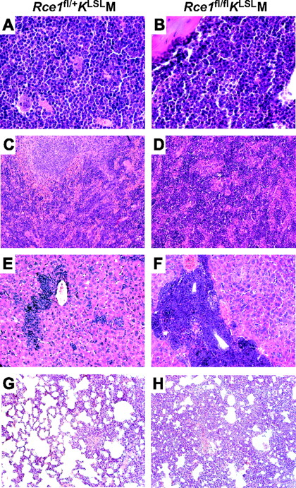 Figure 3. Tissue infiltration of K-RASG12D–expressing myeloid cells. Hematoxylin and eosin–stained sections of tissues from Rce1fl/+KLSLM (left) and Rce1fl/flKLSLM mice (right) harvested 5 weeks after pI-pC injections. (A-B) Bone marrow. (C-D) Spleen. (E-F) Liver. (G-H) Lung. Magnification: 63×/1.40 (A,B); 20×/0.50 (C-H).