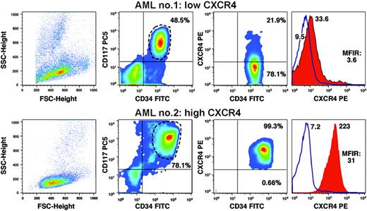 Figure 1. Determination of CXCR4 expression by flow cytometry. The graph displays pseudocolor dot plots of 2 different AML samples with either low CXCR4 surface expression on CD34+/CD117+ AML cells (top row) or high CXCR4 expression (bottom row). The left-hand boxes display the relative size (forward scatter) and granularity (sideward scatter) characteristics of the patients' samples. The second column of boxes displays the relative fluorescence intensities of the AML cell samples stained with fluorescence-labeled anti-CD34 and anti-CD117 antibodies, as displayed on the horizontal and vertical axes, respectively. This allows for gating on the CD34+/CD117+ AML cells, as indicated by the gate drawn around the CD34+/CD117+ population. The percentage of CD34+/CD117+ cells is indicated above each of the populations. The third column of boxes displays relative fluorescence intensities for CD34 and CXCR4, as indicated on the horizontal and vertical axes. The relative proportion of CXCR4-positive and CXCR4-negative cells is displayed next to each of these populations. The right-hand boxes display overlay histogram plots that depict the relative CXCR4 fluorescence intensity of the CD34+/CD117+ AML cells (red-shaded histogram) in comparison with the isotype control stain (blue line). The mean fluorescence intensities are displayed next to each histogram. Moreover, the mean fluorescence intensity ratio (MFIR) for CXCR4 is displayed.