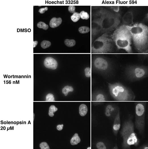Figure 3. FOXO1a localization after treatment with solenopsin. 786-O PTEN−/− cells were infected with AdFKHR and treated with DMSO, wortmannin, or solenopsin. Treatment with the negative control, DMSO, resulted in FOXO1a in the cytoplasm, while treatment with the PI3K inhibitor wortmannin relocalized FOXO1a to the nucleus. Similarly, solenopsin also relocalized FOXO1a to the nucleus. Wortmannin is used as a positive control.