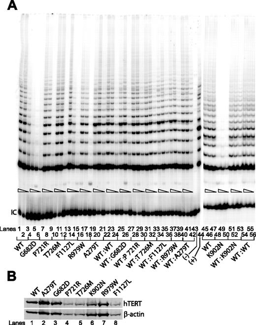 Figure 2. Telomerase enzymatic activities as determined in VA13+hTERC cells for naturally occurring hTERT variants. . / (A) Representative TRAP gels showing the relative telomerase enzymatic activities obtained from the substitution mutations and the wild-type hTERT constructs either individually transfected (lanes 1-21, 45-50) or cotransfected (lanes 22-42, 51-56). Serial 5-fold dilutions of the transfected cell lysates (indicated by triangles) were assayed for each sample to ensure linearity of the PCR-based TRAP assay. Lane 43 shows a negative control composed of wild-type cell lysate denatured at 95°C for 5 minutes prior to assaying. Lane 44 shows PCR products amplified from the non-hTERC control TSR8 DNA template supplied in the TRAP kit. IC indicates PCR products amplified from an unrelated DNA template, which is included as an internal control for PCR amplification efficiency in each reaction. (B) Western blot of wild-type and various natural hTERT variants isolated from transfected cell lysates and probed with an anti-HA probe against the N-terminal HA tag at each of the hTERT constructs.
