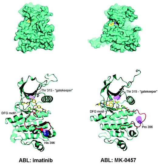 Possible explanation for MK-0457 activity in T315I Bcr-Abl–positive CML and Ph+ ALL. (A) MK-0457 has been shown to be less deeply buried in the Abl kinase domain (right) with respect to imatinib (left). As a consequence, (B) a close encounter with threonine 315 is avoided, explaining the ability of MK-0457 to accommodate easily the substitution of threonine with isoleucine. Modified, with permission, from Young et al5.