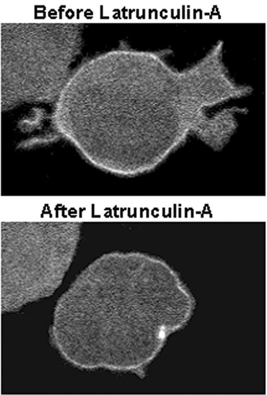 Figure 4. Cellular spreading of pleckstrin-2, but not membrane localization, is dependent on the actin cytoskeleton. Jurkat cells expressing GFP fused to the amino-terminus of wild-type pleckstrin-2 were plated on OKT3. When indicated, 1 μM final concentration latrunculin A was added to the chamber slide. Shown is a cell expressing pleckstrin-2 before and after inhibition of the actin cytoskeleton with latrunculin A for 60 seconds. This figure shows that wild-type pleckstrin-2 associates with membrane projections in cells spread on fibronectin, and this membrane localization remains despite the disruption in cellular spreading by the addition of latrunculin A. Similar results were seen when the actin cytoskeleton was disrupted with cytochalasin D. Images were captured using an UtraVIEW-LCI confocal scanner at × 100 magnification.