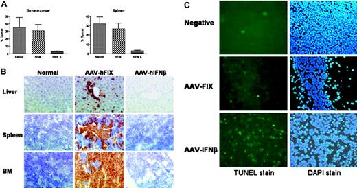Figure 2. Antileukemic efficacy of AAV2/8-mediated hIFN-β expression in a xenograft AML model. (A) HL-60 tumor burden in β2mnull NOD/SCID mice following AAV2/8 hIFN-β gene transfer; quantitative results from fluorescence-activated cell sorter (FACS) analysis of bone marrow and spleen single-cell suspensions. Control animals included a saline-treated cohort and a cohort receiving AAV2/8 hFIX vector. Error bars represent SEM. (B) Human CD45 immunohistochemistry confirming the widespread tissue infiltration of control hFIX-transduced mice with HL-60 cells, in marked contrast to hIFN-β–transduced animals. (C) TUNEL staining of subcutaneous HL-60 tumor implants following systemic transduction with AAV2/8 hFIX or AAV2/8 hIFN-β. The negative tumor control was stained without prior treatment with TdT enzyme. All slides were counterstained with DAPI. Slides were examined using an Olympus BX-51 microscope equipped with a 40×/0.85 numerical aperture oil objective (Olympus, Melville, NY). Images were captured using an Olympus digital camera model U-TVO using the SIS image analysis system (Soft Imaging Systems, Münster, Germany). Adobe Photoshop version 5 (Adobe Systems, San Jose, CA) was used to edit the images.