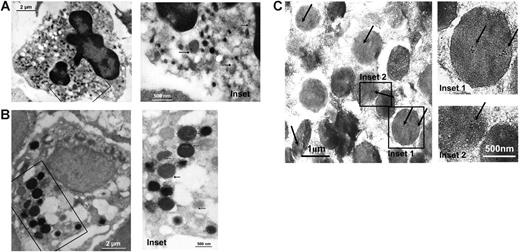 Figure 1. TF storage in eosinophil myelocytes. In thin sections of human bone marrow, TF is found to be expressed in intracellular compartments of leukocyte progenitor cells. The hematopoietic cells were visualized by immunoelectron microscopy, using a monoclonal anti-TF antibody and a secondary antibody coupled with gold particles. (A) Neutrophil metamyelocytes (recognized by their characteristic nuclear morphology and the dense heterochromatin) and (B) basophil myelocytes (identified by the morphology and size of their intracellular granules) contain TF in different types of granules. (C) In the eosinophil myelocytes, high amounts of TF are expressed in the coreless granules (identified by the presence of arginine-rich crystals in intracellular granules). The marked areas in the left-hand pictures are magnified on the right-hand side. Arrows indicate specific TF labeling.