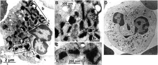Figure 2. Detection of TF expression in peripheral blood eosinophils. Immediately processed whole blood was scanned to identify leukocytic sources of TF. In mature (unstimulated) eosinophils (A), the protein is predominantly stored in the specific granules (arrows in the insets in panels B and C), low amounts being present on membranes of other cell organelles in the cytoplasm. (D) TF is practically absent from mature neutrophils. N indicates nucleus.