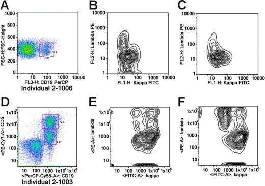 Figure 3. Flow cytometry of 2 unaffected individuals with MBL. Panels A-C show data on 2-1003; panels D-F, on 2-1006. (A) Analysis of whole blood stained with CD19 PerCP. The plot shows forward scatter versus CD19-isolating B cells. (B) Overall kappa-positive clone. (C) A subgate showing that the CD5 population is monoclonal (kappa light chain restricted). (D) The analysis of StemSep-enriched B cells (StemSep, Vancouver, BC, Canada). The plot shows CD19PerCP Cy5.5 versus CD5 PE Cy7. The top box shows a bright CD5 population, and the bottom box shows a dim CD5 population. (E) A subgate showing that the brighter CD5 population shown in panel D is monoclonal (kappa light chain restricted). (F) A subgate showing that the lower dim CD5 population present in panel D is polyclonal.