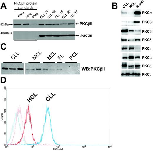 Figure 1. Profile of PKC isoform expression in mature B lymphocytes. (A) Quantitation of PKCβII expression in CLL cells by Western blotting. Equal amounts of protein were used from each CLL patient, and the intensity of the PKCβII-reactive band was compared with that generated from known amounts of recombinant PKCβII. β-Actin was used to indicate equal protein loading. (B) Western blot analysis of PKC isoform expression by CLL, HCL, and CD19-purified normal B cells. Equal amounts of protein were analyzed for each PKC isoform and cell type. This figure is representative of 3 separate experiments with different patients. (C) Western blot analysis of PKCβII expression in CLL cells, mantle cell lymphoma (MCL) cells, marginal zone lymphoma (MZL) cells, follicular lymphoma (FC) cells, and plasma cell leukemia (PCL) cells. Equal amounts of protein were loaded for each cell type. (D) Flow cytometric analysis of PKCβII expression in permeabilized CLL and HCL cells. This figure is representative of 2 separate experiments in different patients with CLL and HCL.