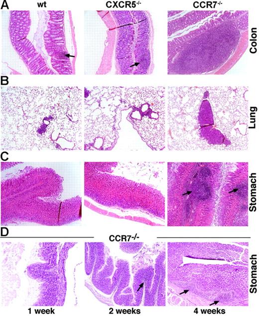 Figure 1. Lymphoid follicle-like aggregates are formed within the mucosal tissue of the gastrointestinal and respiratory tract of CCR7−/− mice. (A) Colons of wt and CXCR5−/− mice (representative lymphoid follicle indicated by an arrow) exhibited normal numbers of gut-associated lymphoid aggregates compared with CCR7−/− mice. In CCR7−/− animals, lymphoid aggregations were larger and more frequent. (B) Mucosal tissue of the lung exhibited enhanced lymphoid aggregates in CCR7−/− mice (depicted at the age of > 6 months) compared with wt and CXCR5−/− mice. (C) Mucosal tissue of the stomach of wt and CXCR5−/− mice showed no lymphoid infiltrates, whereas CCR7−/− mice harbored a large number of lymphoid follicular-like structures within the submucosa and lamina propria. (D) In the mucosal tissue of the stomach, aberrant lymphoid infiltrates were already detected at the age of 2 weeks in CCR7−/− mice (indicated by an arrow). At the age of 4 weeks, the onset of follicular-like aggregates was first observed (indicated by arrows). Data are from 1 representative mouse of 6 to 8 mice analyzed per group (A-D). Original magnification, ×100 (A-D); hematoxylin-eosin (HE) staining of paraffin-embedded tissue.