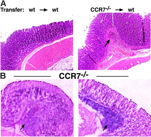 Figure 5. The formation of aberrant lymphoid aggregates is a direct consequence of CCR7 deficiency and not due to inflammatory stimuli. (A) Stable bone marrow chimeras were generated, resulting in a donor chimerism greater than 95%. The phenotype of chimeric mice was analyzed 8 weeks after BM transplantation by hematoxylin staining in paraffin-embedded sections. Transfer of wt bone marrow (CD45.2) (4 × 107) into irradiated congenic wt recipients (CD45.1) did not elicit the formation of lymphoid infiltrates in the mucosal tissue of the stomach (left). Transfer of CCR7-deficient bone marrow cells into wt recipients resulted in the formation of lymphoid aggregates in the gastric mucosa (right). Data are representative of 4 to 6 mice in each group. Original magnification, ×100. (B) CCR7−/− mice raised under sterile conditions still developed aberrant lymphoid follicular-like structures in the gastric mucosa. Numerous aberrant lymphoid infiltrates were detected within the submucosa and lamina propria (indicated by an arrow) of CCR7−/− mice raised under vancomycin, metronidazole, and ampicillin treatment over 8 weeks. Histologic sections from 2 representative mice of 8 are shown. Magnification, ×100; HE staining of frozen tissue sections.