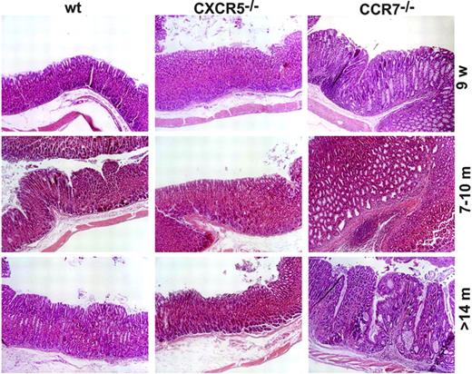 Figure 6. Lack of CCR7 causes hypertrophic gastropathy that resembles Menetrier disease. Comparison of gastric mucosa histology between CCR7−/−, CXCR5−/−, and wt mice shows thickening (hypertrophy) of the mucosa of CCR7−/− mice between 9 weeks and 18 months of age. Progressive mucosal hyperplasia with dilated cysts lined with a single layer of cuboidal epithelium was regularly observed in the gastric fundic mucosa of aged CCR7-deficient mice (10 to 18 months). Wt and CXCR5−/− mice showed minimal or no pathomorphologic changes from 9 weeks to 18 months of age. One representative mouse is shown of 6 to 8 mice per group. Original magnification, ×100; HE staining in paraffin-embedded sections.